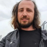 Shkoi në Turqi për të mbjellë flokët, vdes pas transplantit 36-vjeçari shqiptar