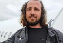 Shkoi në Turqi për të mbjellë flokët, vdes pas transplantit 36-vjeçari shqiptar