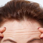 Keni rrudha në ballë? Çfarë tregojnë ato për shëndetin e zemrës