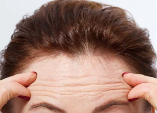 Keni rrudha në ballë? Çfarë tregojnë ato për shëndetin e zemrës