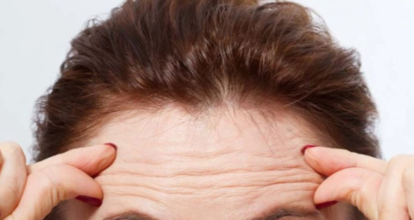 Info Shqip: Keni rrudha në ballë? Çfarë tregojnë ato për shëndetin e zemrës