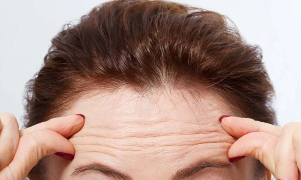 Keni rrudha në ballë  Çfarë tregojnë ato për shëndetin e zemrës