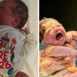 Dy vajza janë bebet e para të lindura në vitin 2026 në Shqipëri