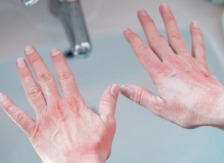 Duart e thata: Një truk menjëherë pas larjes parandalon tharjen