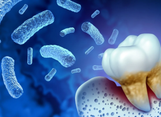 Sëmundja e mishrave të dhëmbëve mund ta përkeqësojë sklerozën multiple dhe ta rrisë invaliditetin