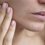 A mund të shërohet lëkura e thatë vetëm duke pirë ujë?