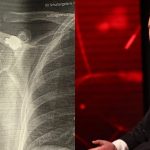 I mbijetuari i luftës zbulon pas 27 vitesh plumbin në trup: Metali që mposhta për të shijuar lirinë e Kosovës