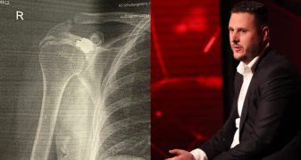 Info Shqip: I mbijetuari i luftës zbulon pas 27 vitesh plumbin në trup: Metali që mposhta për të shijuar lirinë e Kosovës