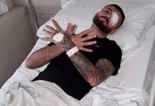 U plagos rëndë në sy gjatë protestës, Vishkulli reagon pas operacionit në Itali: Po përballem me një tjetër sfidë