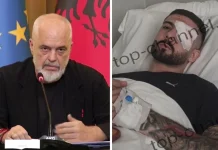 Rama reagon për plagosjen e 28-vjeçarit në sy: U kujdesa personalisht të shkojë në spitalin më të mirë në Itali