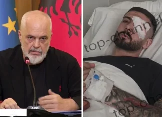 Rama reagon për plagosjen e 28-vjeçarit në sy: U kujdesa personalisht të shkojë në spitalin më të mirë në Itali