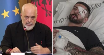 Info Shqip: Rama reagon për plagosjen e 28-vjeçarit në sy: U kujdesa personalisht të shkojë në spitalin më të mirë në Itali